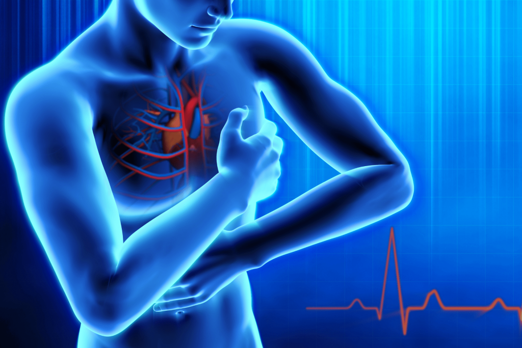 Brugnoni-Group-Sanita-blog-cardiologia-infarto
